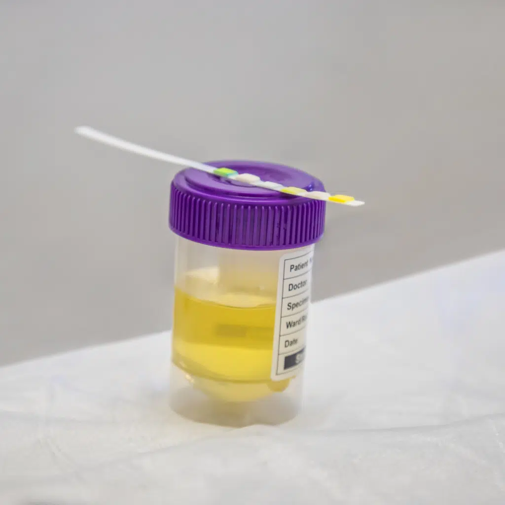 alcohol test