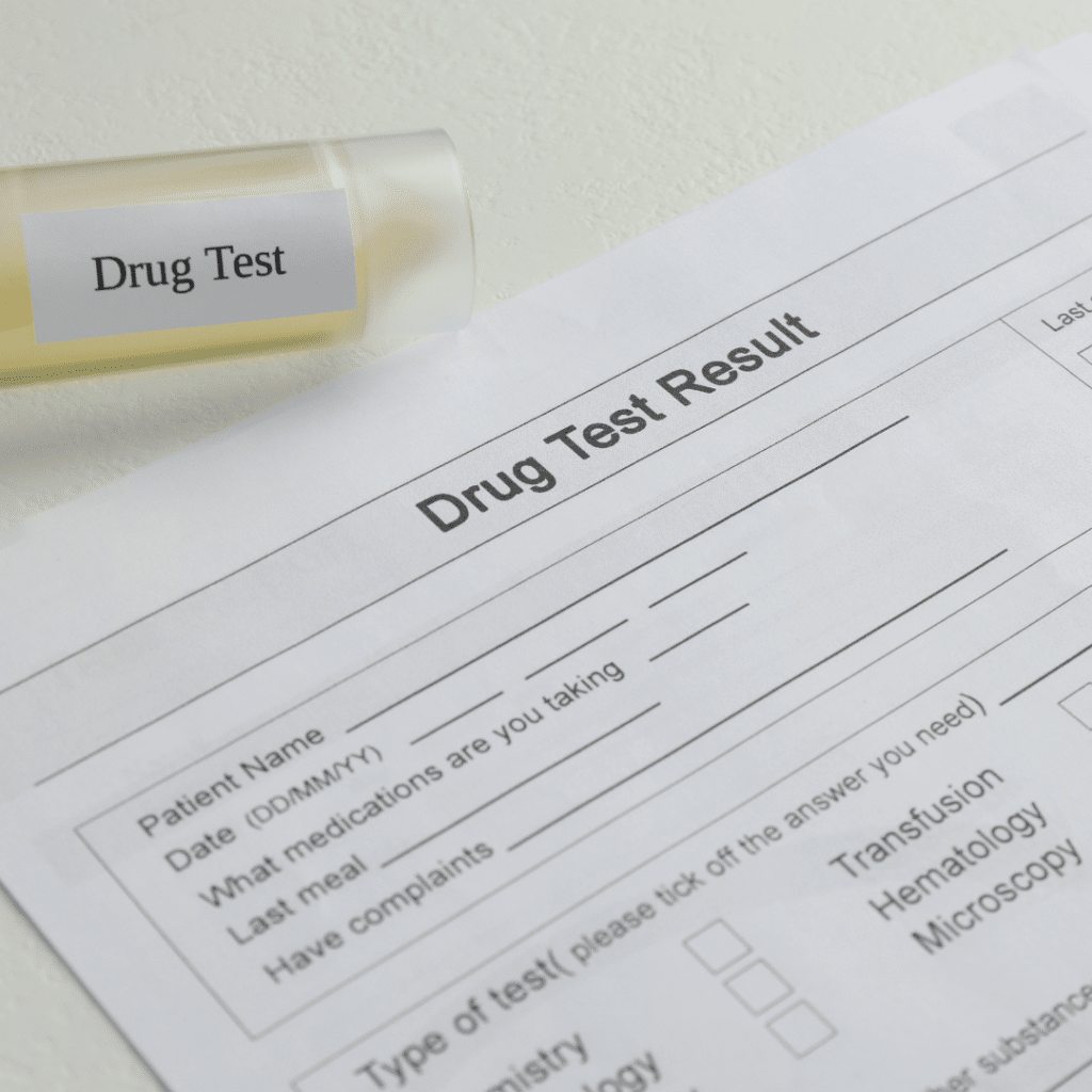 employer drug testing