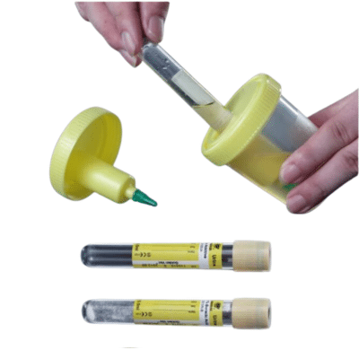 Urine Container Kit - Urine Specimen Kit w Needle Cup and Vacuum Tube